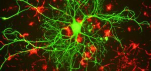 Kannabinoidy mogą spowolnić rozwój choroby Parkinsona, THCLand.pl